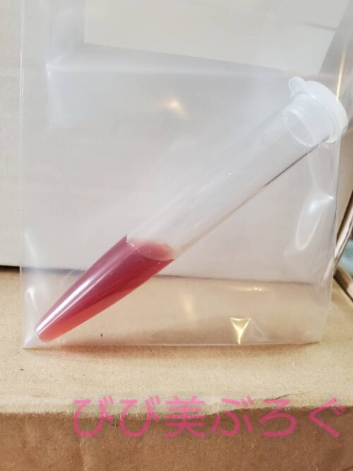 血尿